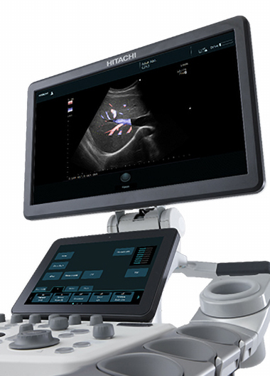 高解像度の検査機器