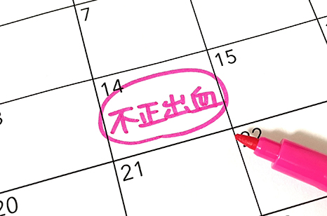 不正出血のスケジュール